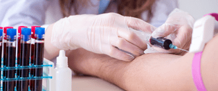 blood testing rosewell
